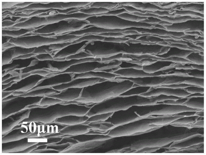 The Next Stop for Energy Density Improvement: Opportunities with Lithium Metal Anodes 